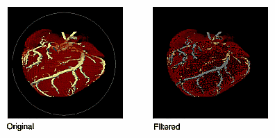 Figure 4-19 Median Rank Filtering on an Image